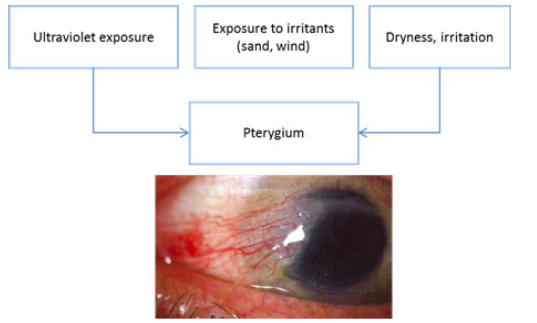 Pseudopterygium